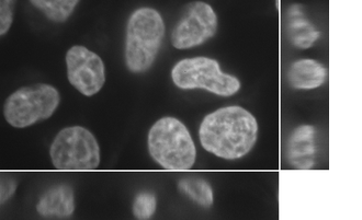 Chan-Vese segmentation