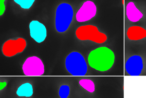 Chan-Vese segmentation