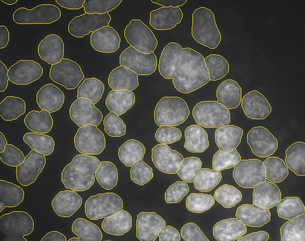 Geodesic segmentation