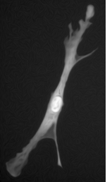 Multi-phase Chan-Vese segmentation