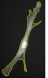 Multi-phase Chan-Vese segmentation