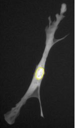 Multi-phase Chan-Vese segmentation